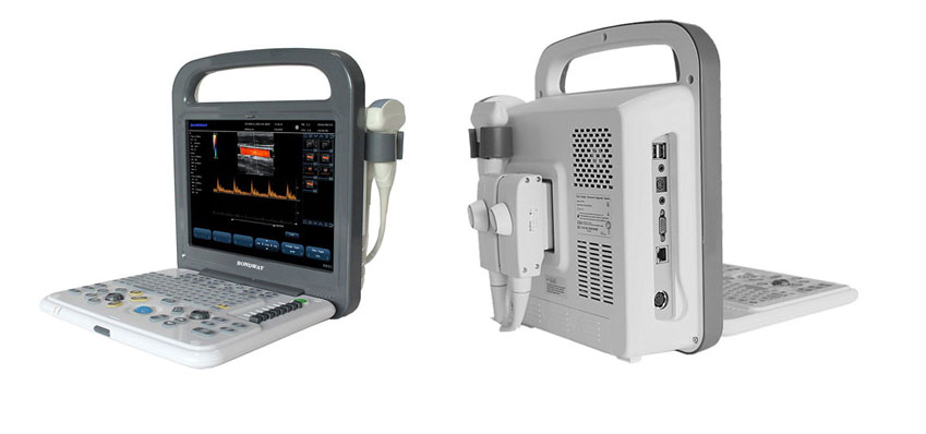 Side view of ES240 Color Doppler diagnostic ultrasound system